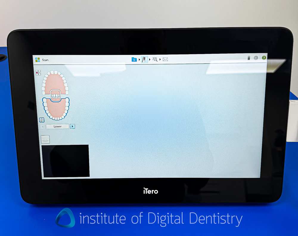 itero_lumina_iDD_review_institute_of_digital_dentistry_align_technology10