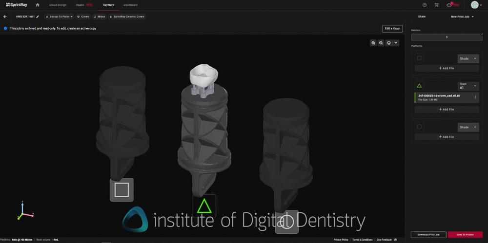 itero_lumina_iDD_review_institute_of_digital_dentistry_align_technology3