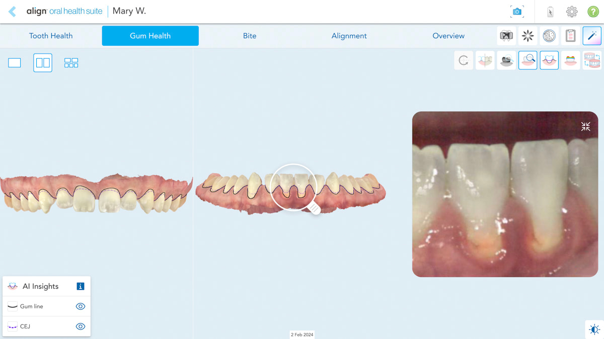 Gumlines Viewing Tool