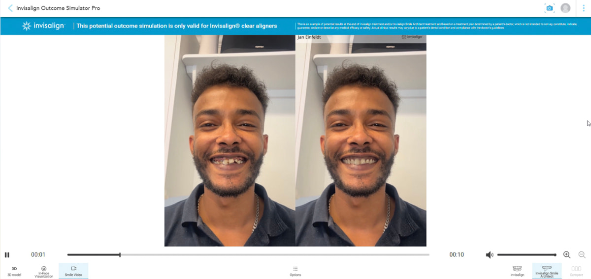 IO Sim Pro with Smile Video