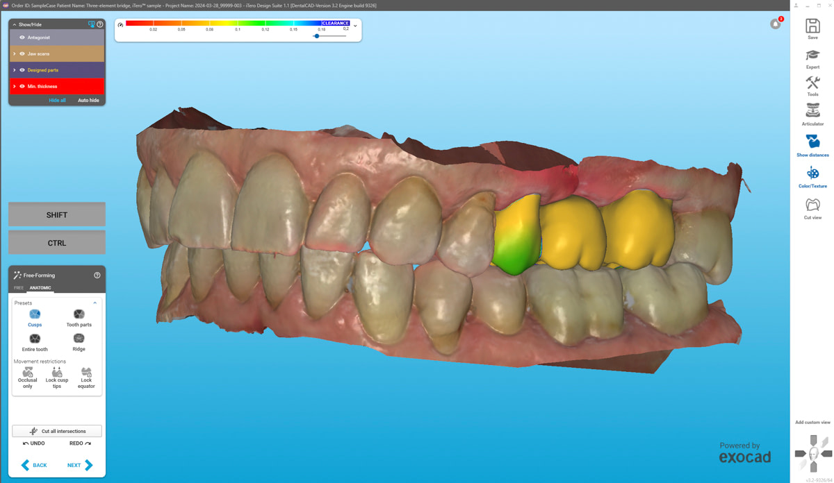 iTero Design Suite Mock-up (1)