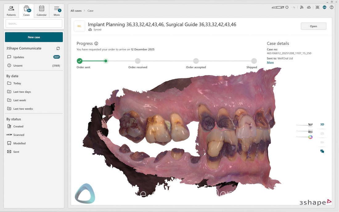 3Shape_TRIOS_6_Review_IDD_Software1