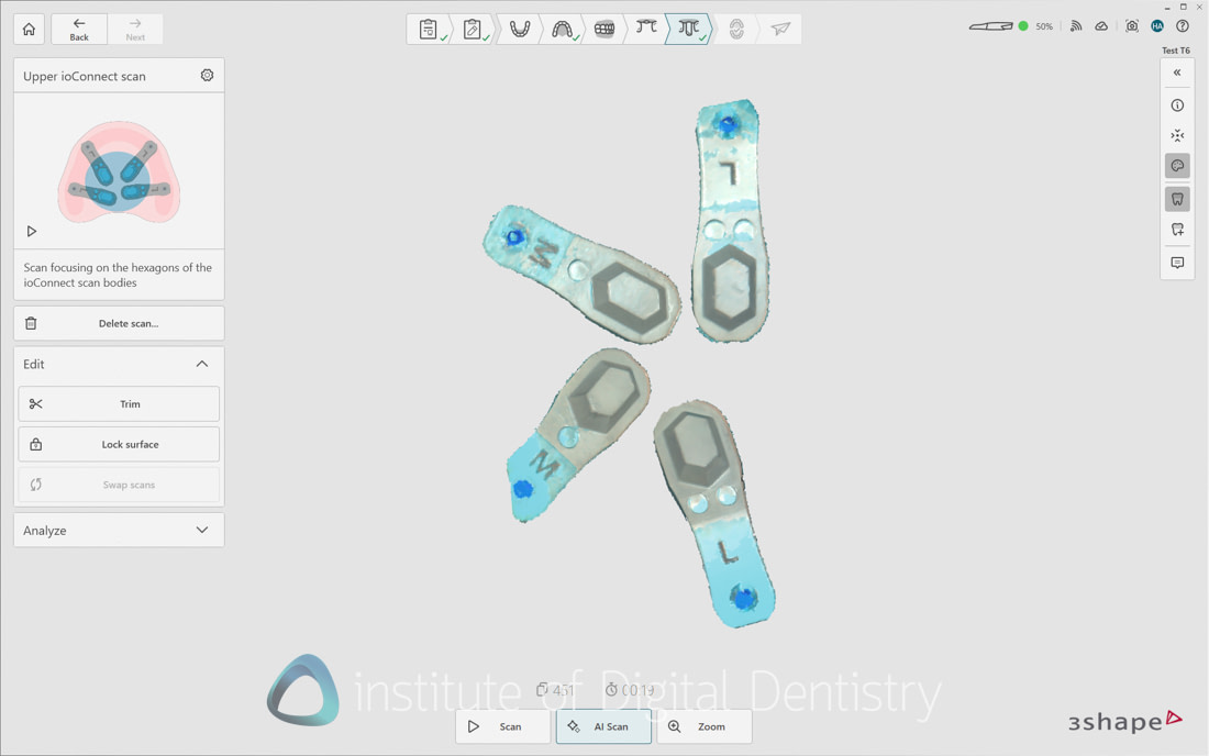 3Shape_TRIOS_6_Review_IDD_Software17
