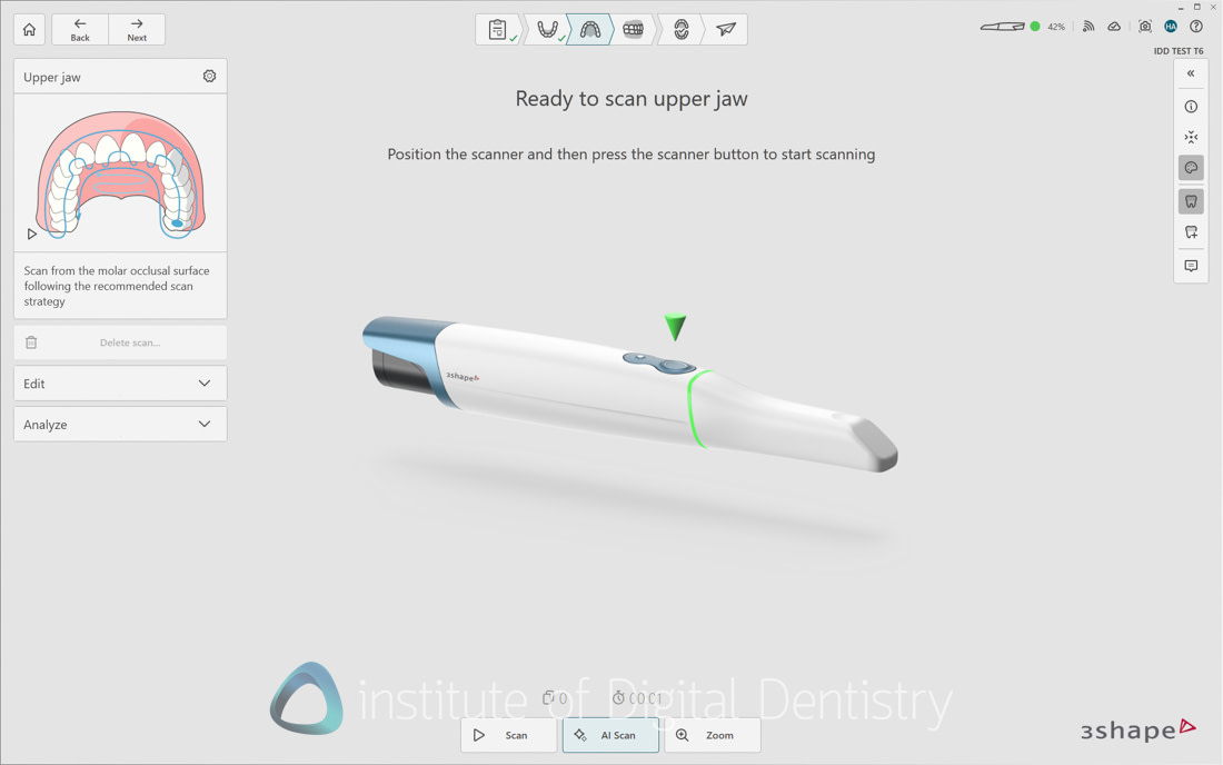 3Shape_TRIOS_6_Review_IDD_Software19