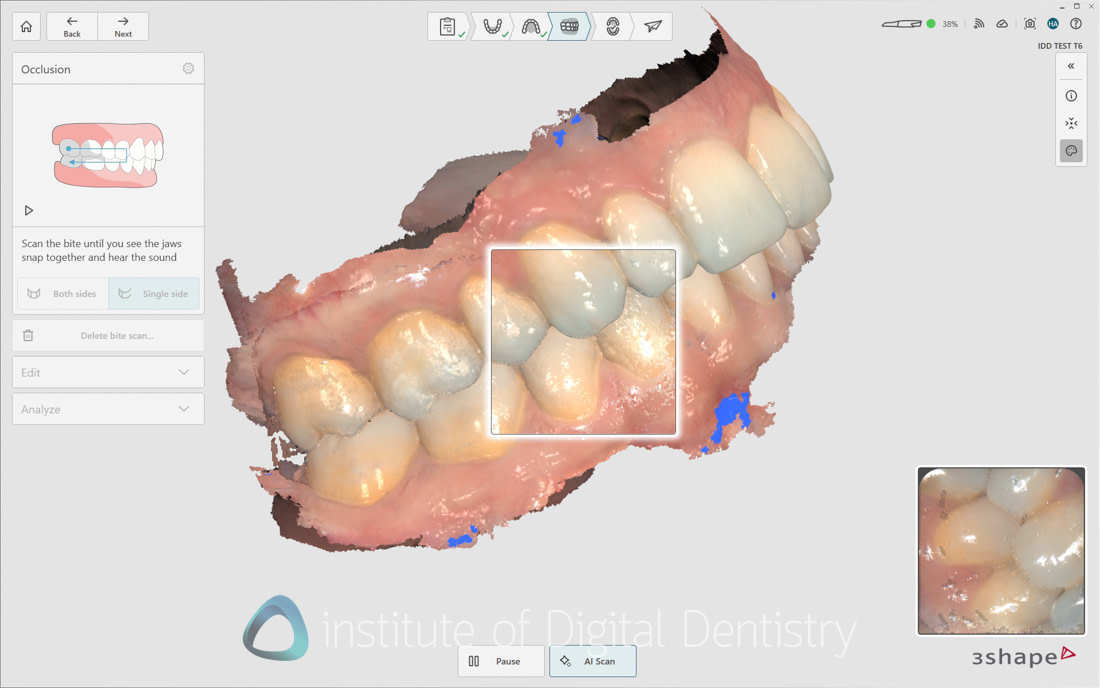 3Shape_TRIOS_6_Review_IDD_Software24