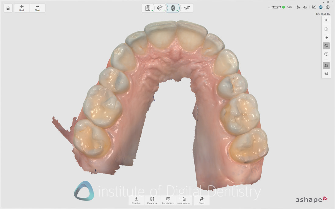 3Shape_TRIOS_6_Review_IDD_Software28