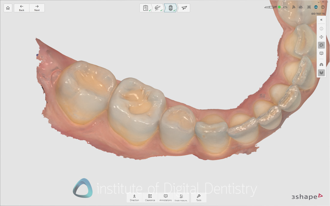3Shape_TRIOS_6_Review_IDD_Software36