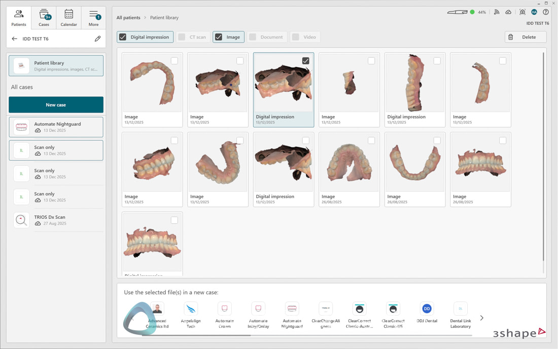 3Shape_TRIOS_6_Review_IDD_Software41