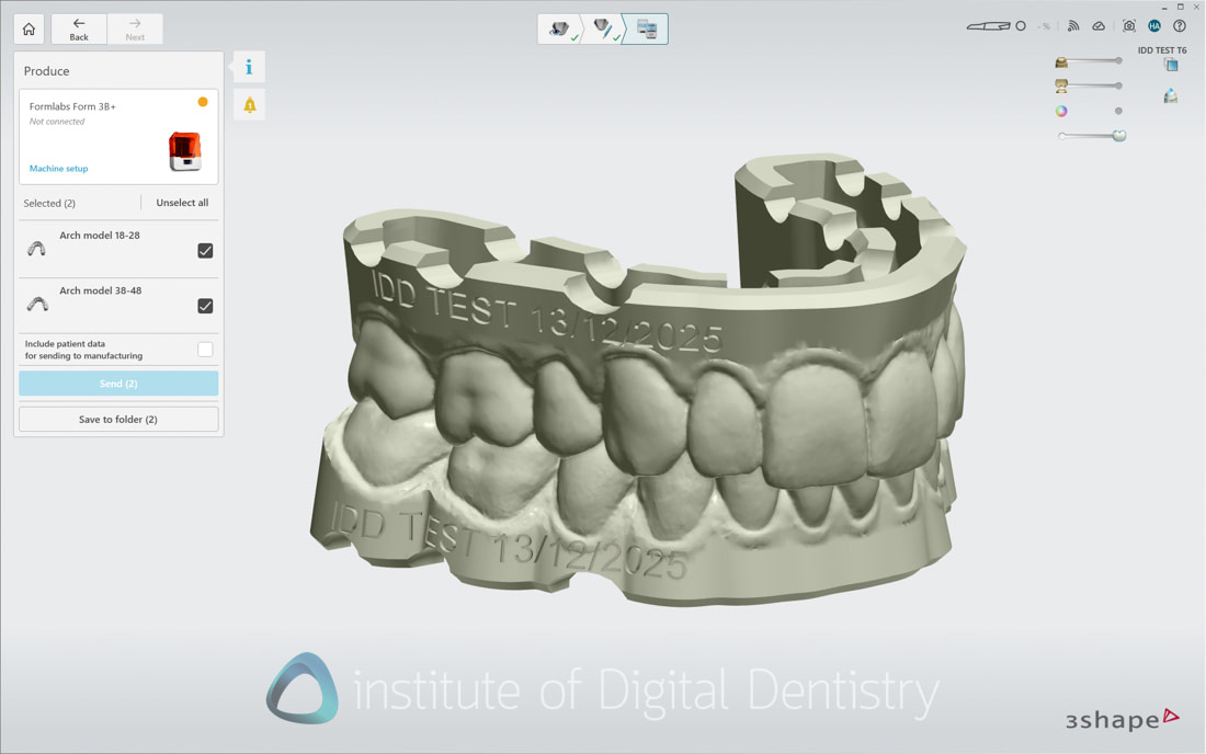 3Shape_TRIOS_6_Review_IDD_Software44