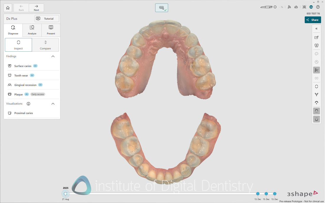 3Shape_TRIOS_6_Review_IDD_Software45