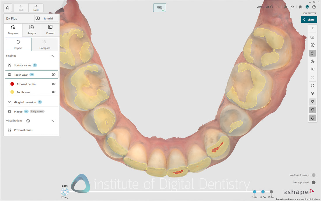 3Shape_TRIOS_6_Review_IDD_Software47