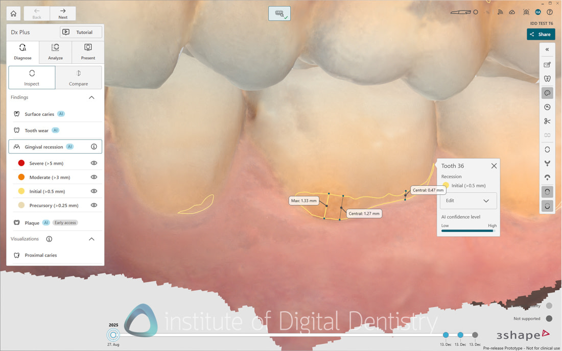 3Shape_TRIOS_6_Review_IDD_Software48
