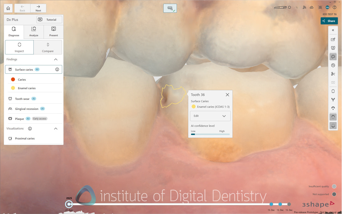 3Shape_TRIOS_6_Review_IDD_Software49