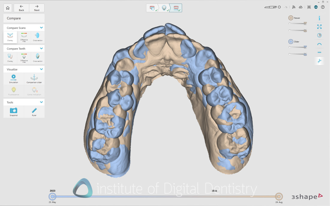 3Shape_TRIOS_6_Review_IDD_Software56