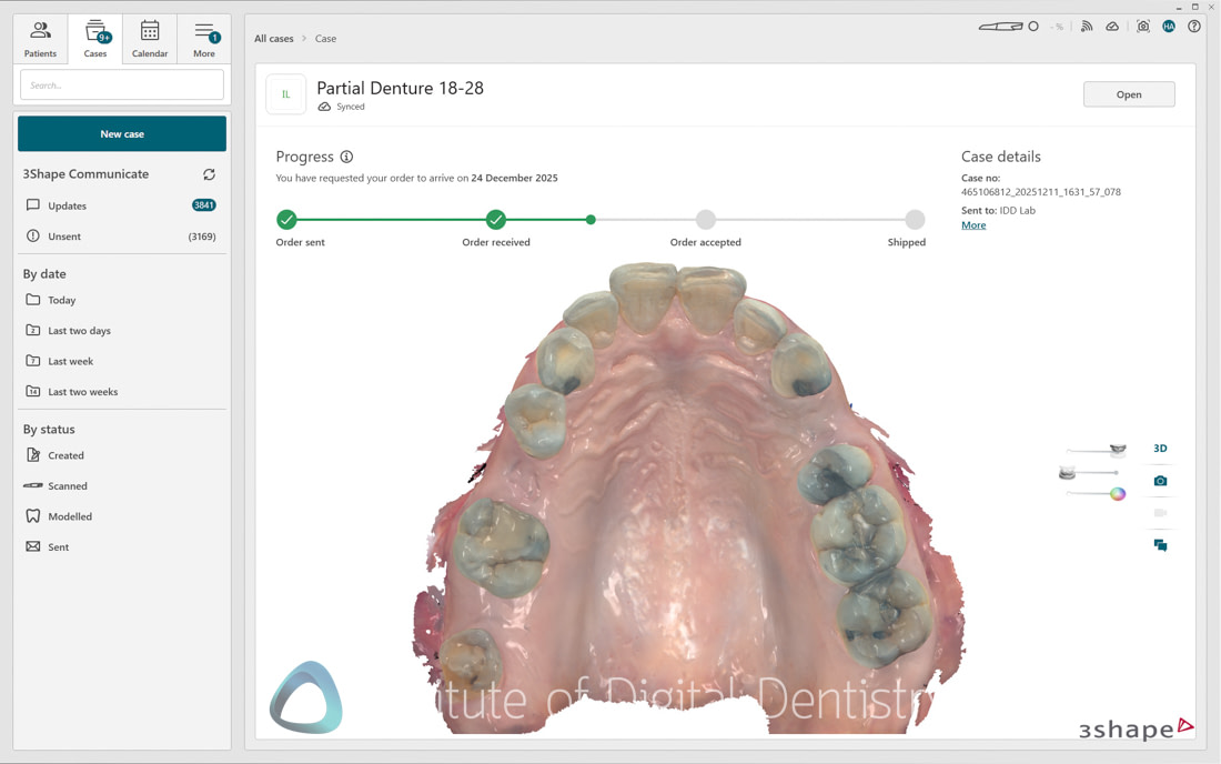 3Shape_TRIOS_6_Review_IDD_Software59
