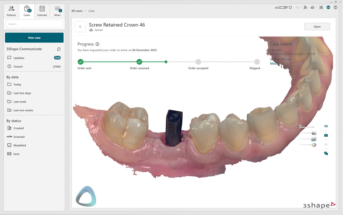 3Shape_TRIOS_6_Review_IDD_Software61