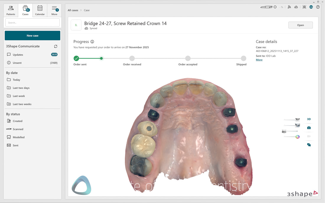 3Shape_TRIOS_6_Review_IDD_Software63