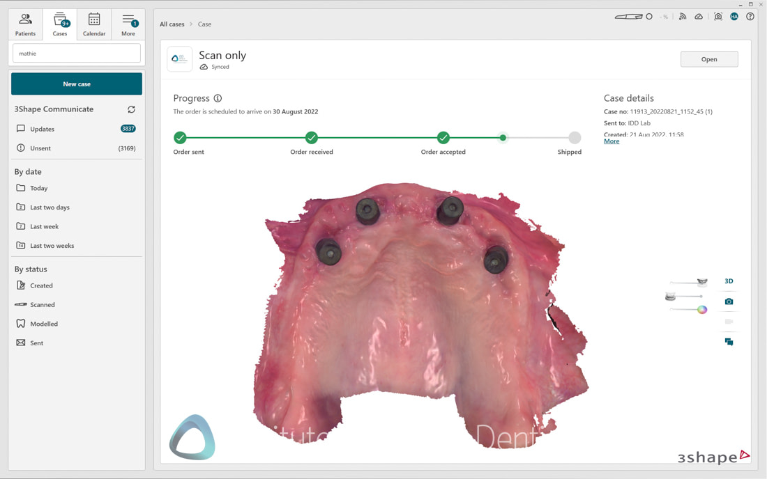 3Shape_TRIOS_6_Review_IDD_Software65