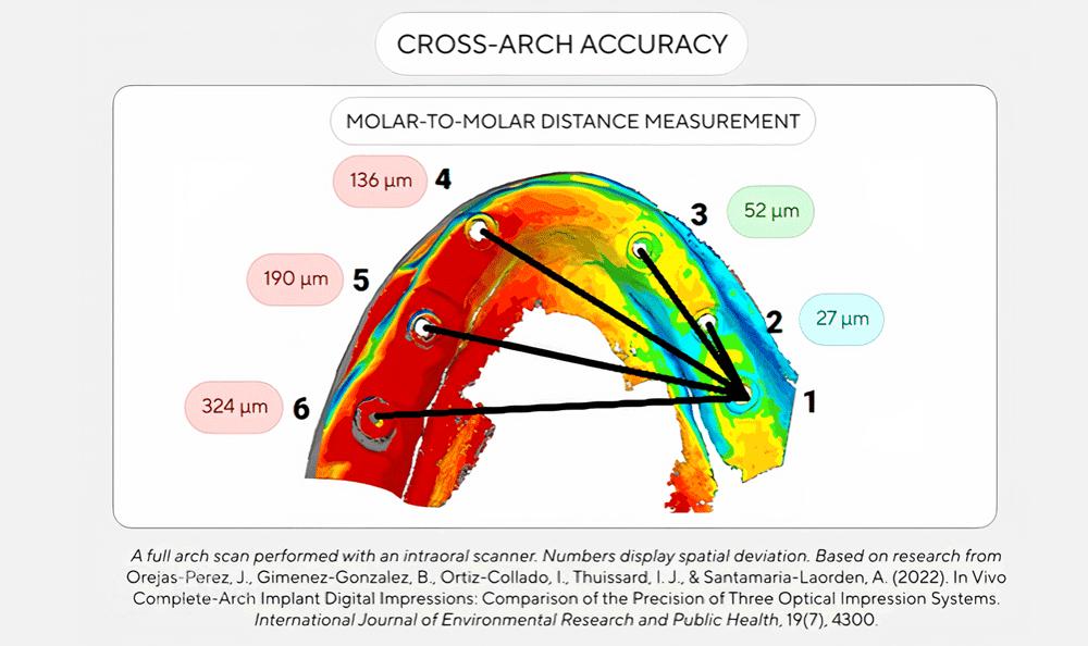 full_arch_implant_scan_accuracy