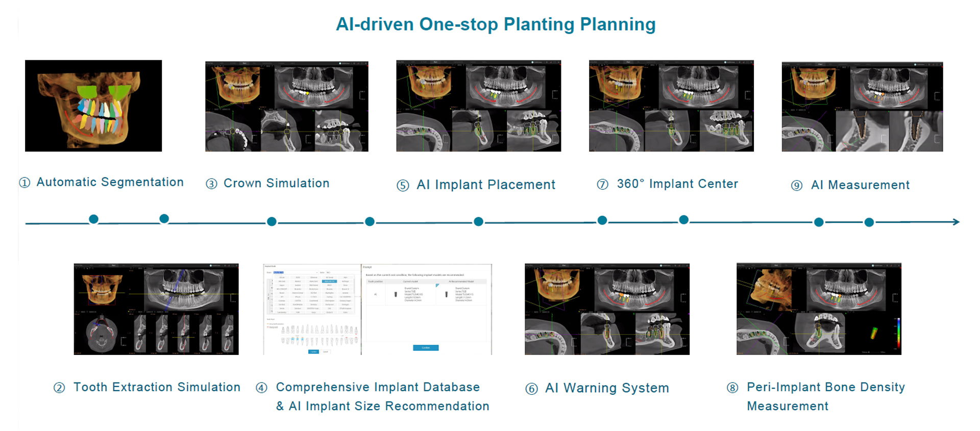 AI-implant-surgical-guide-design-15 AI Diagnostic Features -Fussen