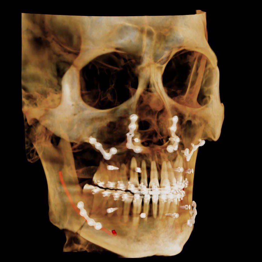CBCT-image_6