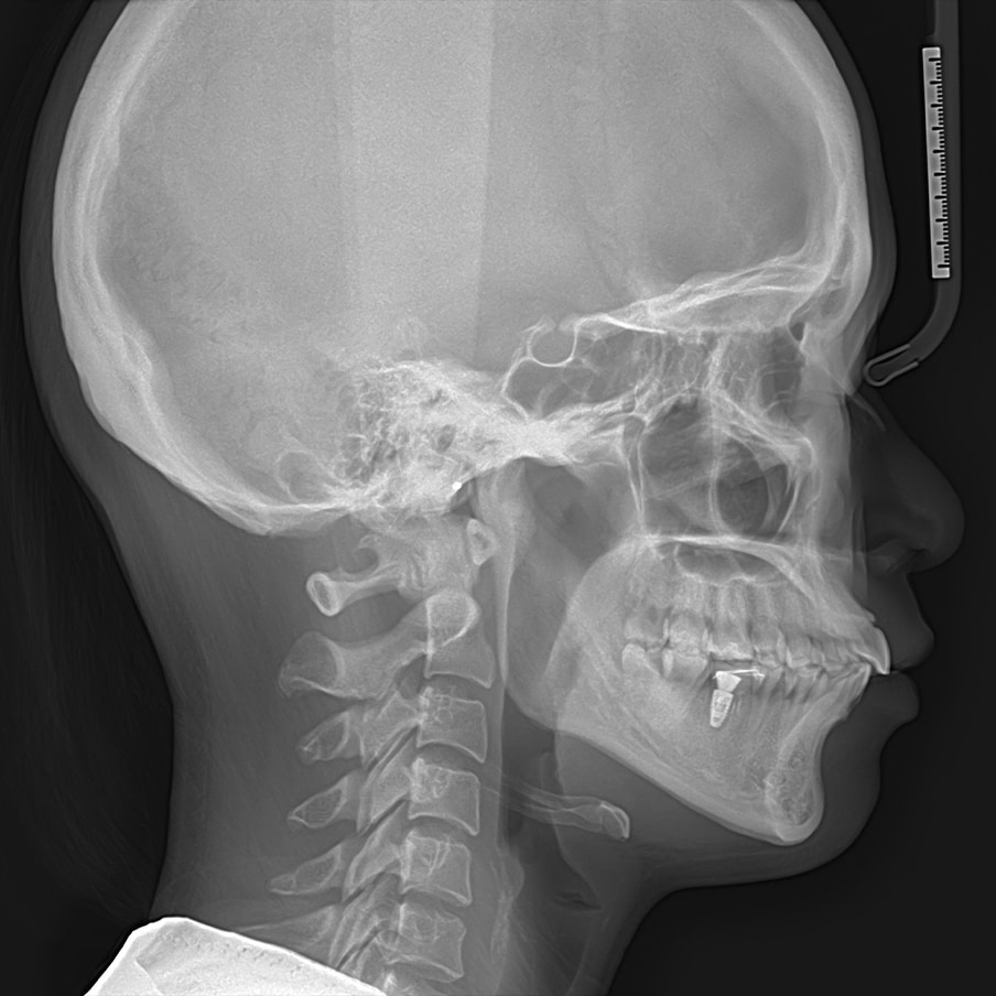 CBCT-image_7