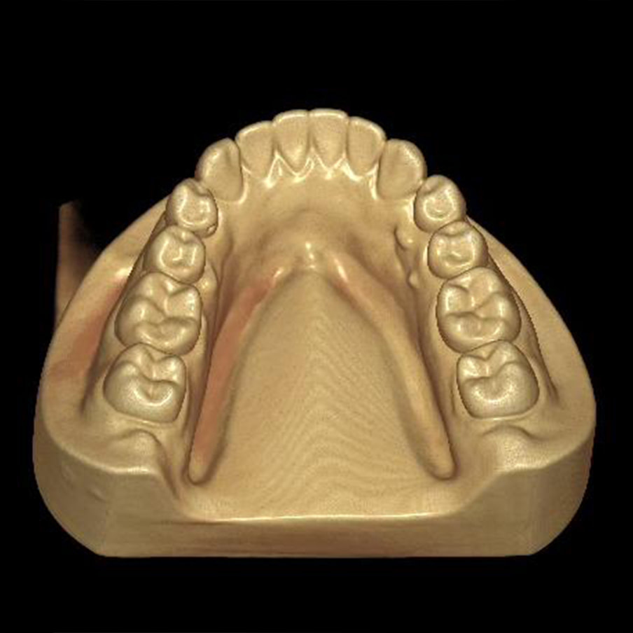 CBCT-image_8