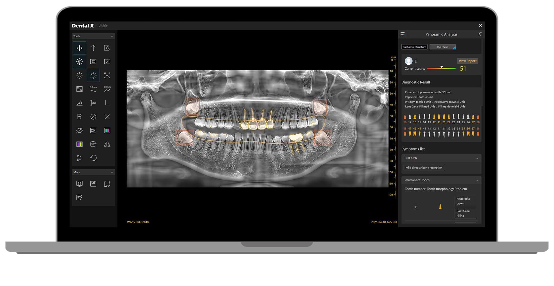 Hero-image-Dental-X2.0-Platform 10 Hardware specifications worth understanding_ CBCT Rubik X