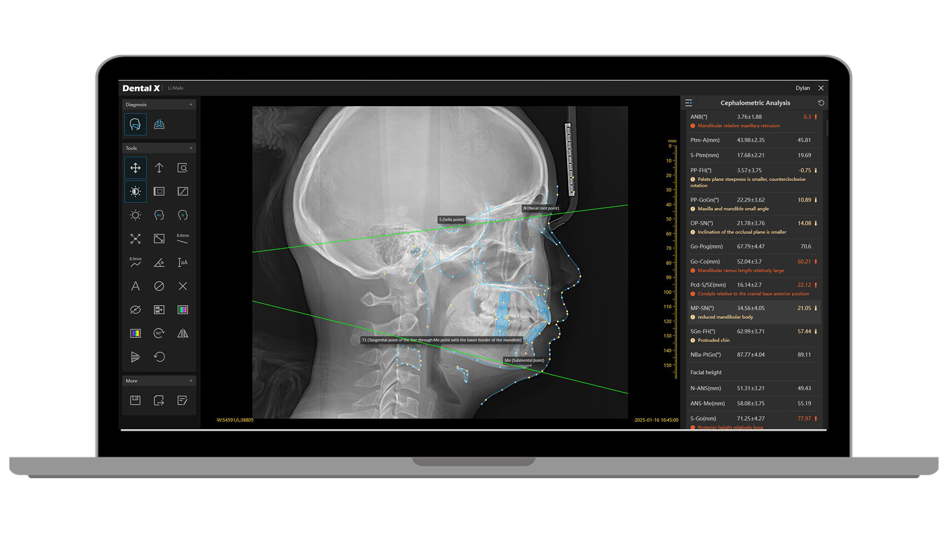 Hero-image-Dental-X2.0-Platform-11