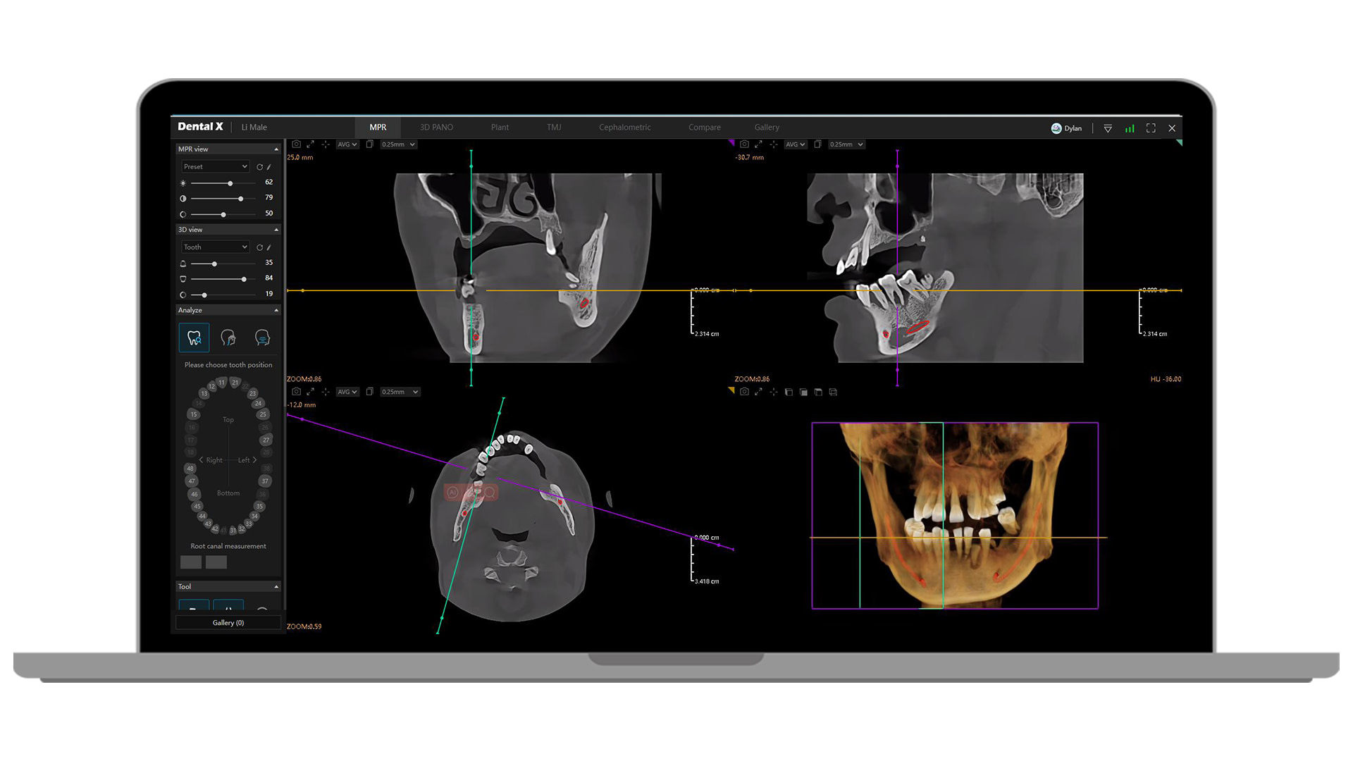 Hero-image-Dental-X2.0-Platform-12