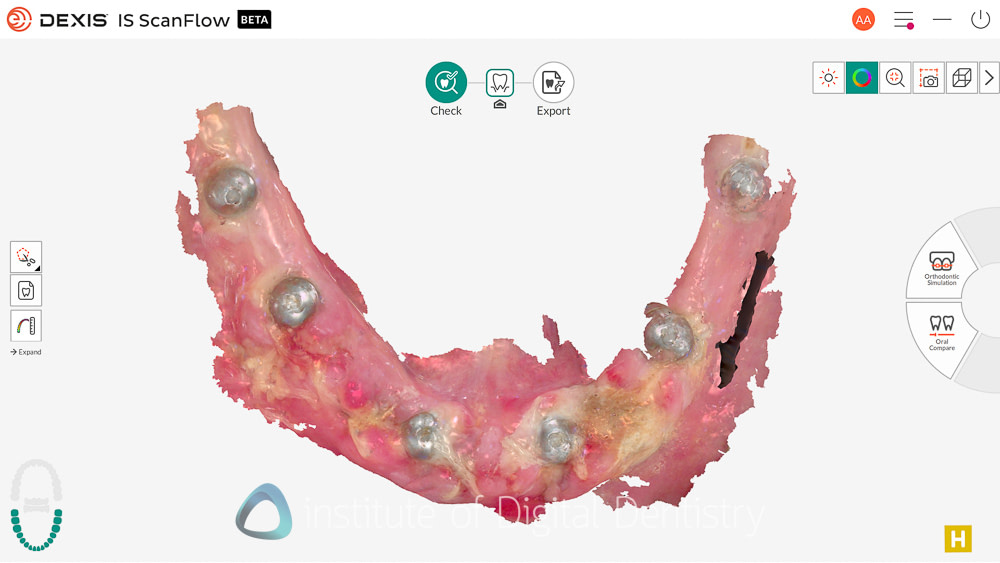 DEXIS_IMPREVO_REVIEW_INSTITUTE_OF_DIGITAL_DENTISTRY23