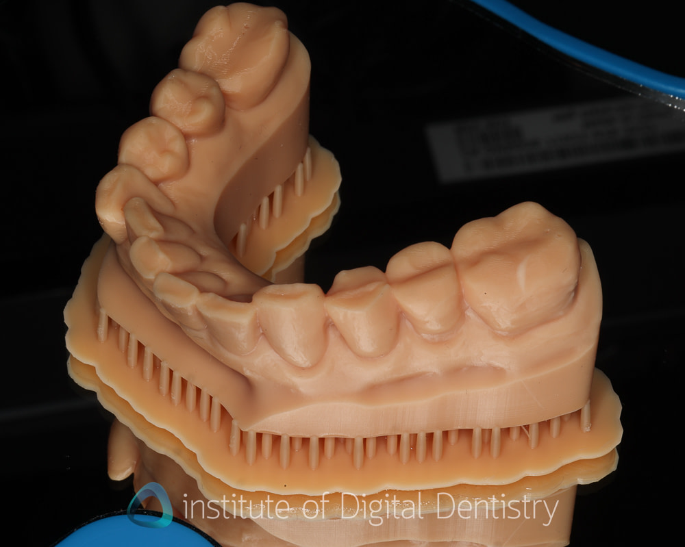 Phrozen_dental_printer_review_CS+_wash_Institute_of_digital_dentistry2