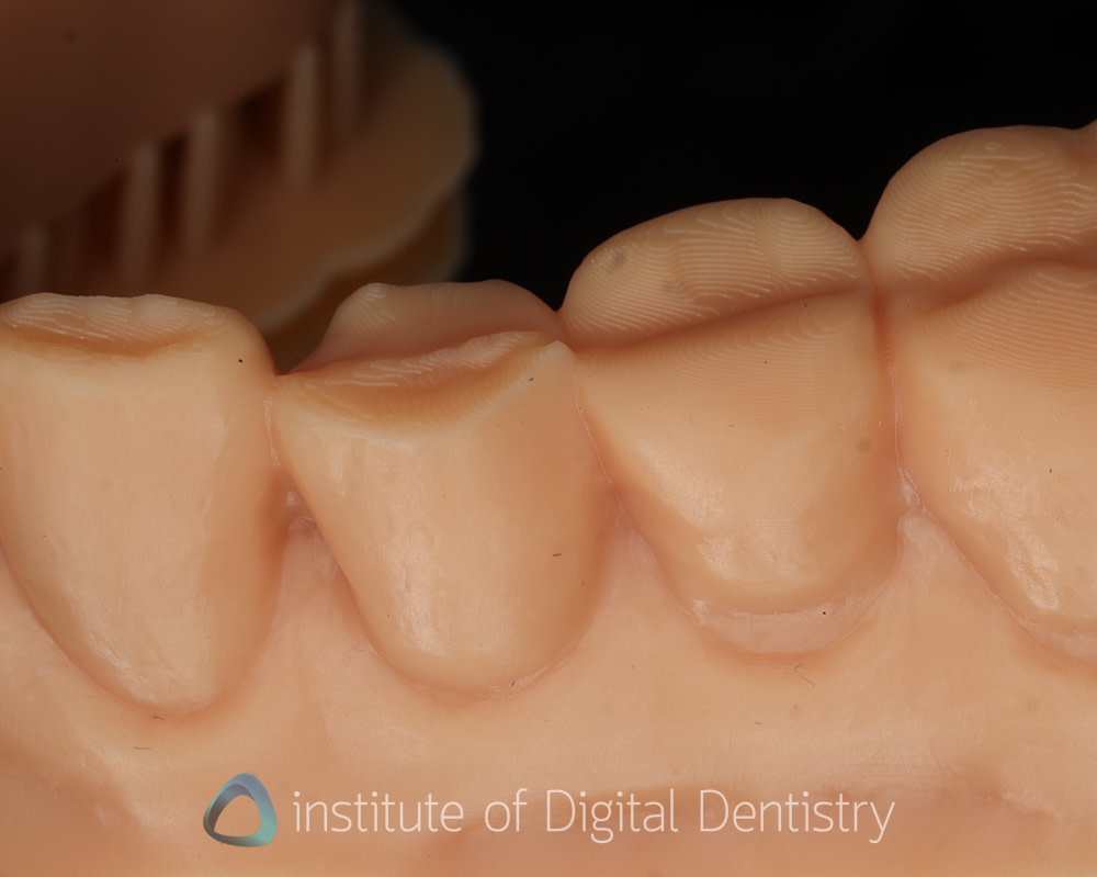 Phrozen_dental_printer_review_CS+_wash_Institute_of_digital_dentistry3