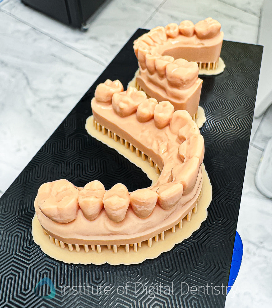 Phrozen_dental_printer_review_CS+_wash_Institute_of_digital_dentistry34