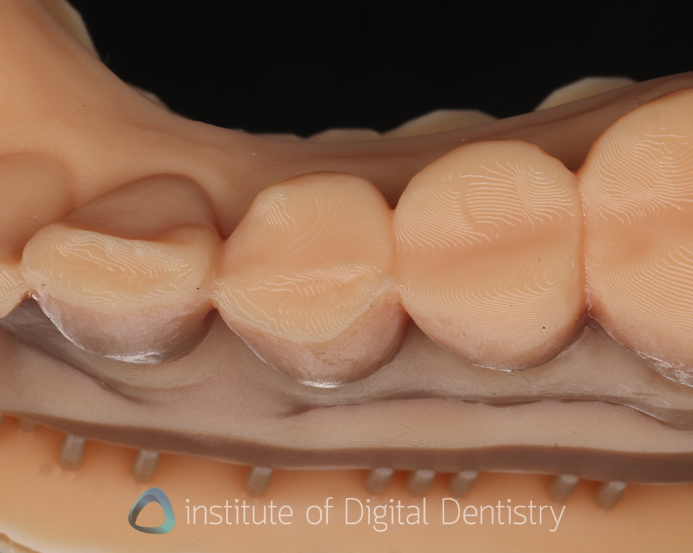 Phrozen_dental_printer_review_CS+_wash_Institute_of_digital_dentistry4
