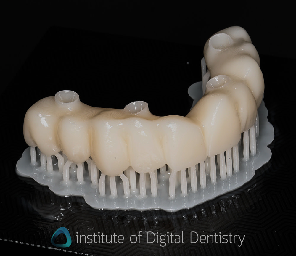 Phrozen_dental_printer_review_CS+_wash_Institute_of_digital_dentistry5
