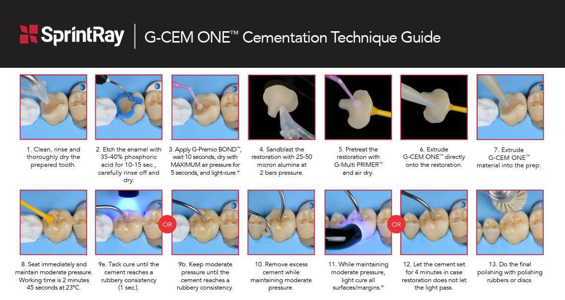 G-CEM ONE-Technique