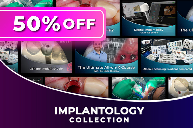 Implant-Collection-50-off