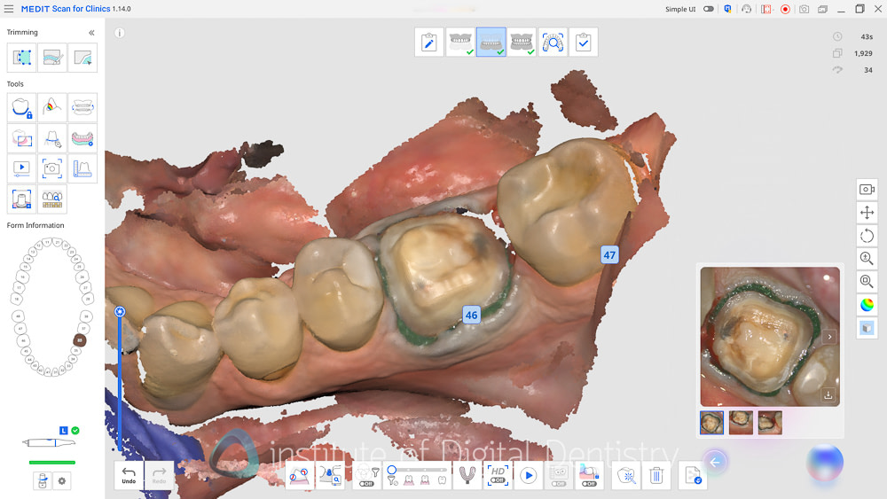medit_realtime_intelligence_iDD_Review18