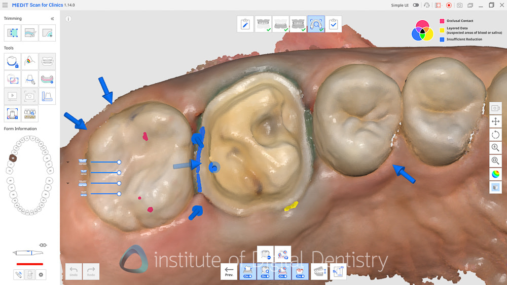 medit_realtime_intelligence_iDD_Review22