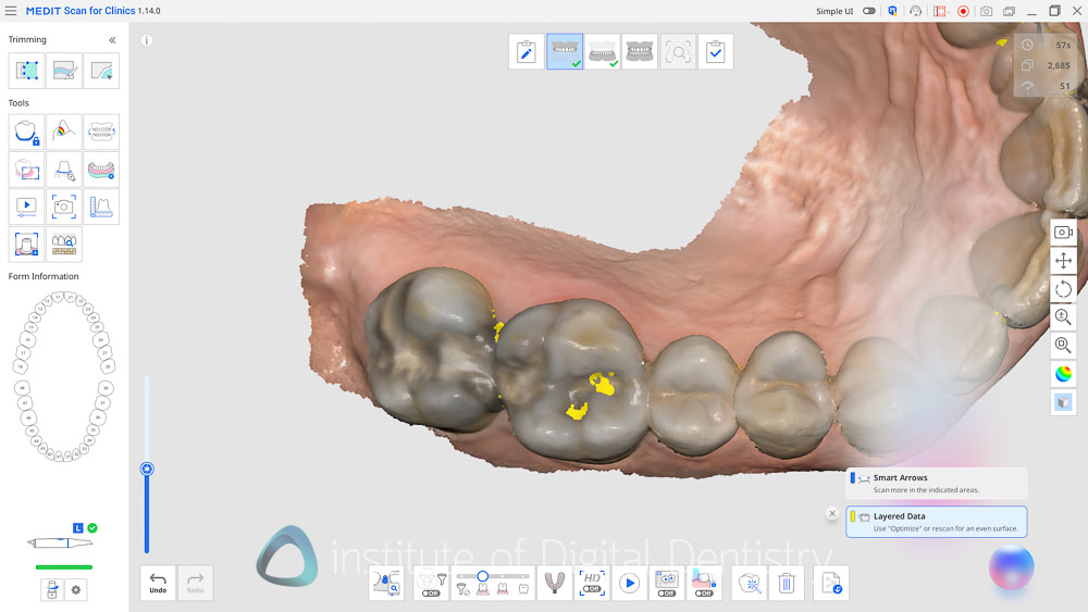 medit_realtime_intelligence_iDD_Review5