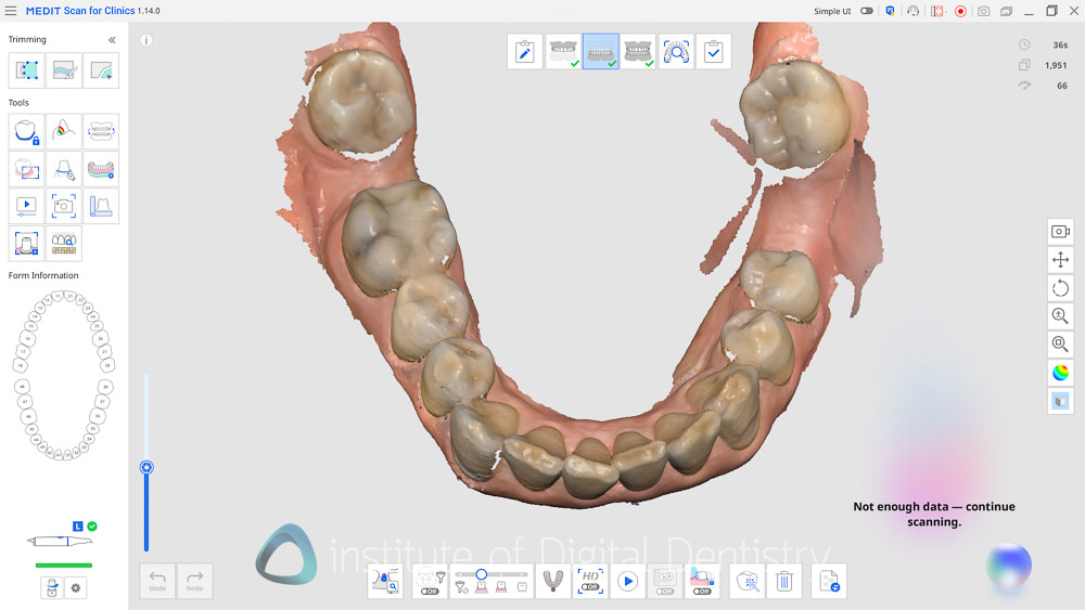 medit_realtime_intelligence_iDD_Review6