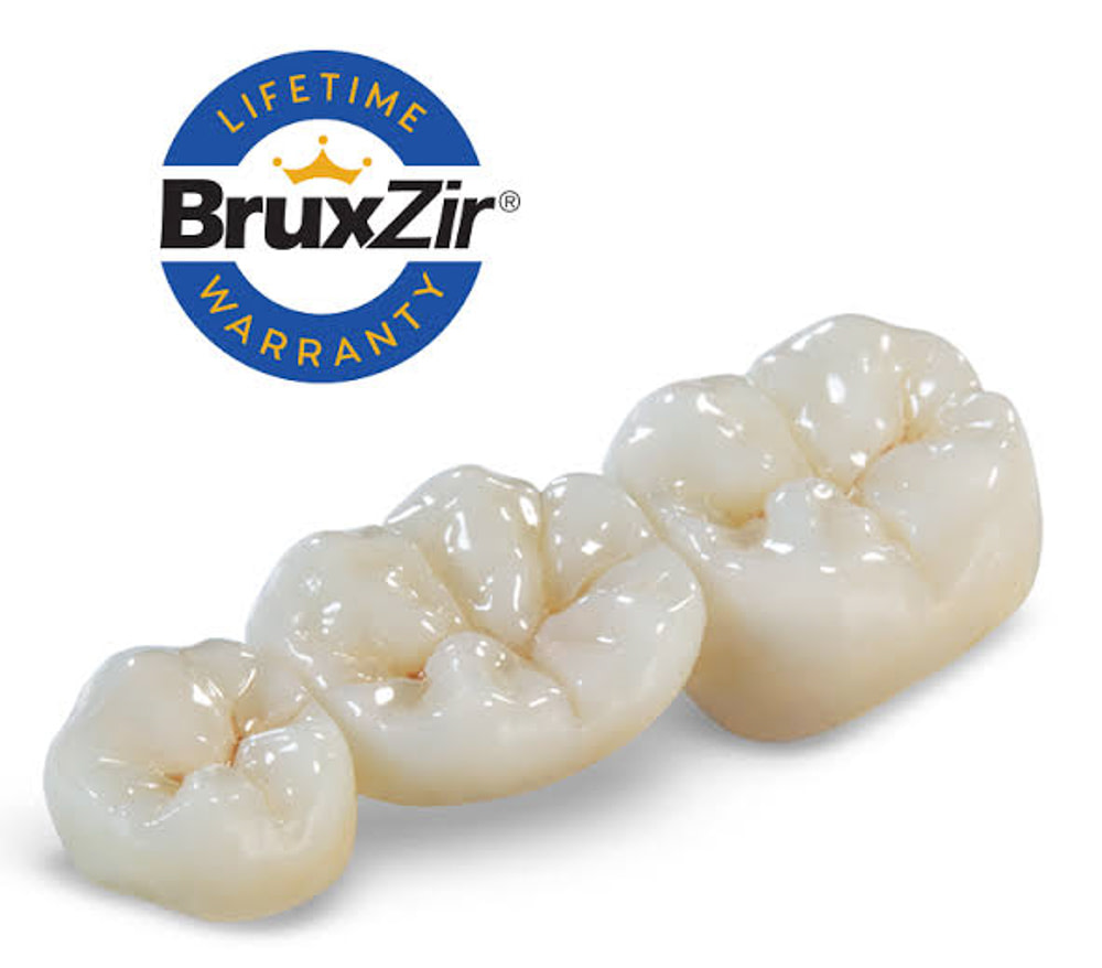 3D_printed_crowns_vs_zirconia_emax2