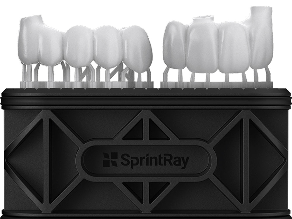 3D_printing_midas_veneers_vs_emax2