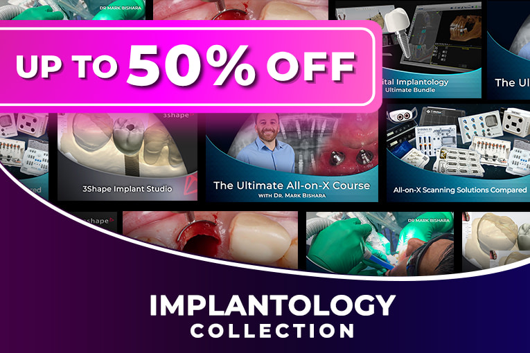 Implantology Collection-upto50off