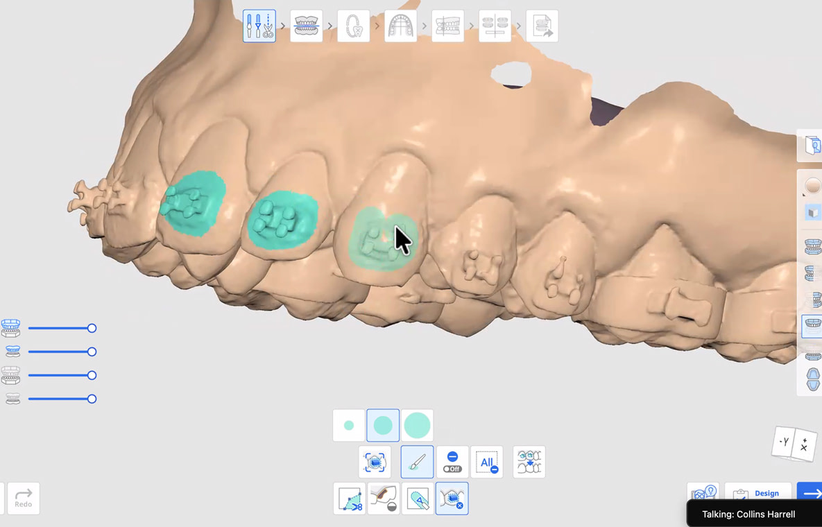 medit-ortho-suite-03