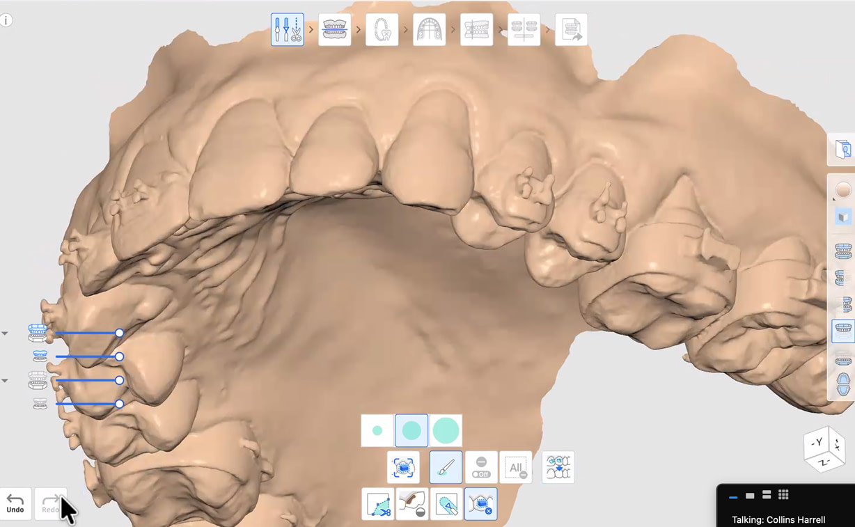 medit-ortho-suite-04