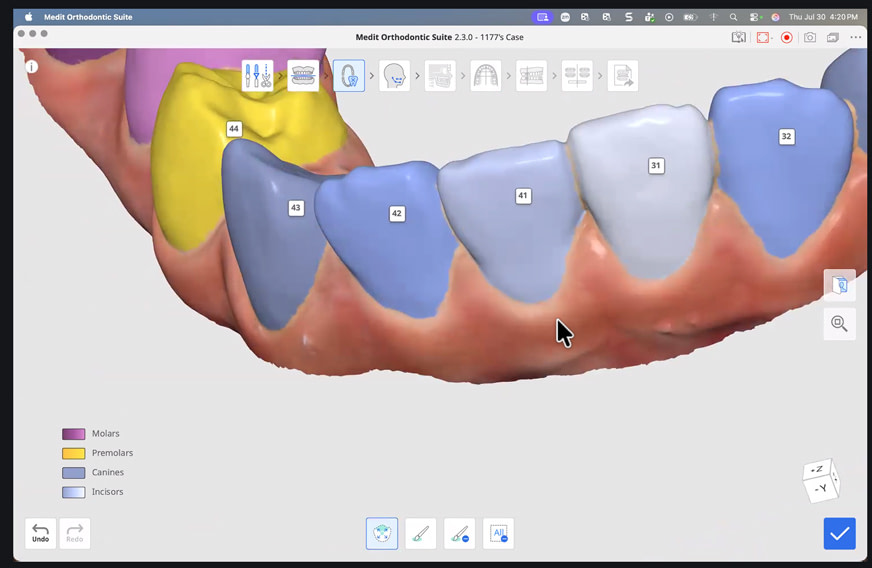 medit-ortho-suite-11