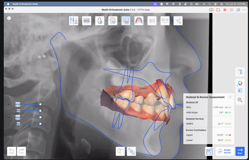 medit-ortho-suite-12