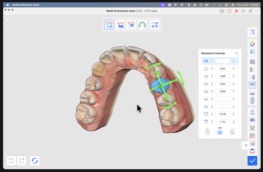medit-ortho-suite-16